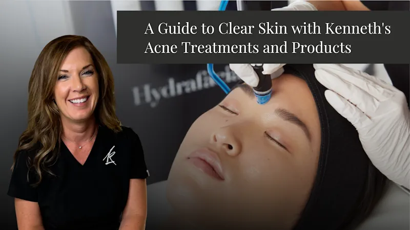 A Guide to Clear Skin Acne Treatments and Clear Skin 