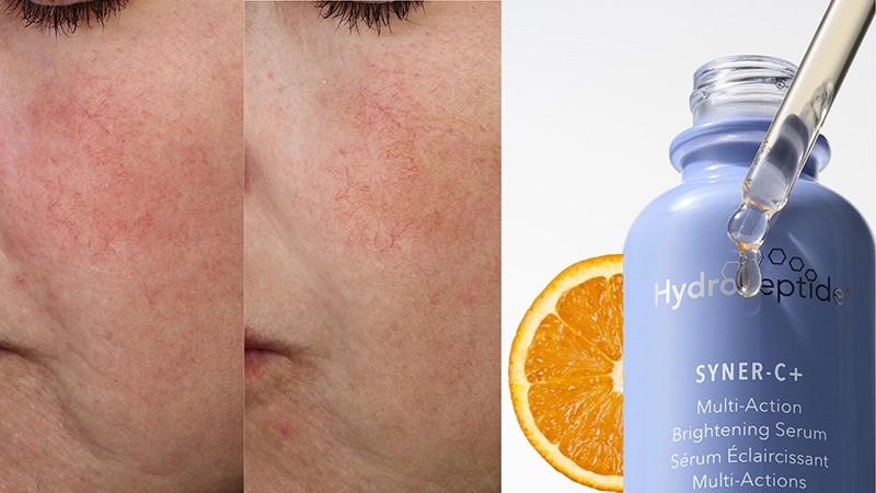Image of Syner C+ Product from HydroPeptide