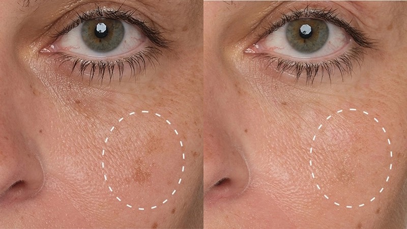 Image of skin benefitting from product use