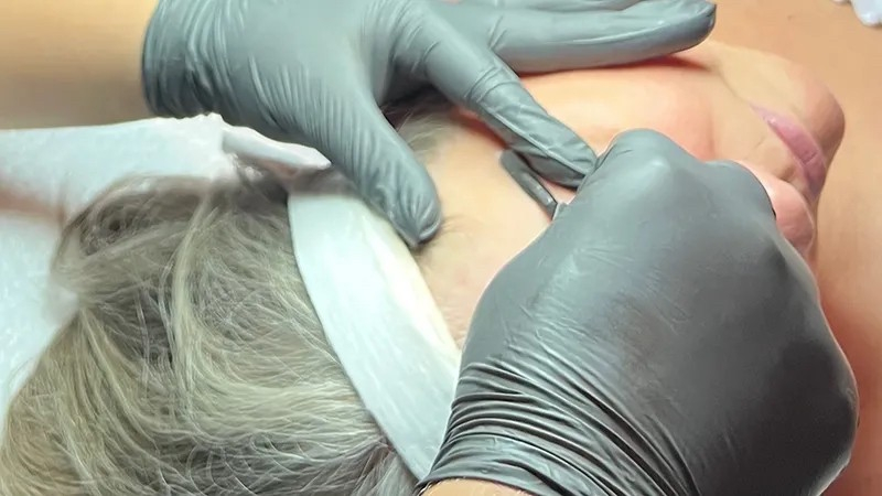 older woman getting a dermaplane 