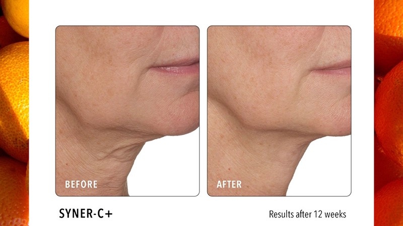 Image of side by side before and after skin