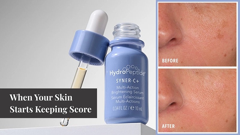 When Your Skin Starts Keeping Score
