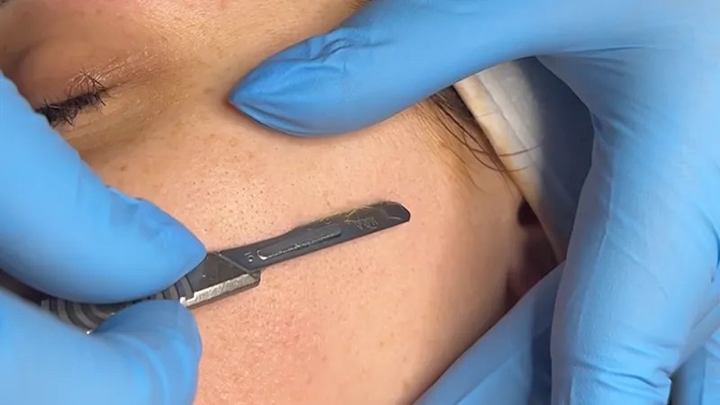 Why Millennials love this package. Instant results